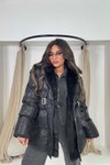 Siyah Şişme Kürklü Mont
